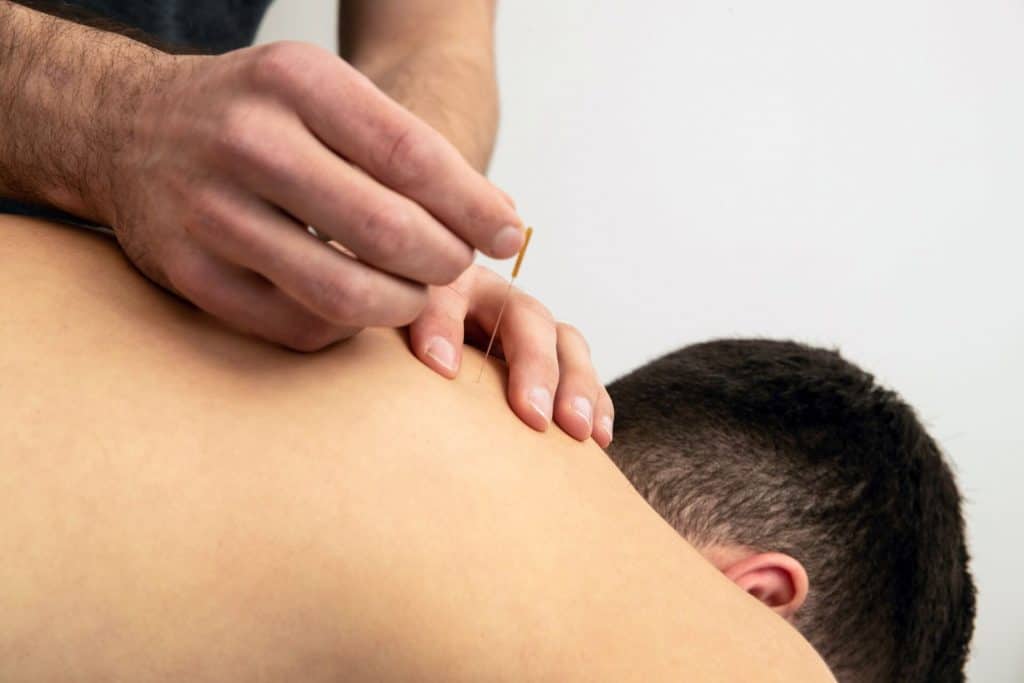 Dry Needling in Huissen, Bemmel en Doornenburg